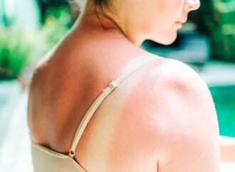 Moderna mRNA vaccine almost halves the risk of skin cancer returning