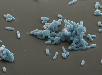 Plague scare: what scientists know — and what Russia won’t say