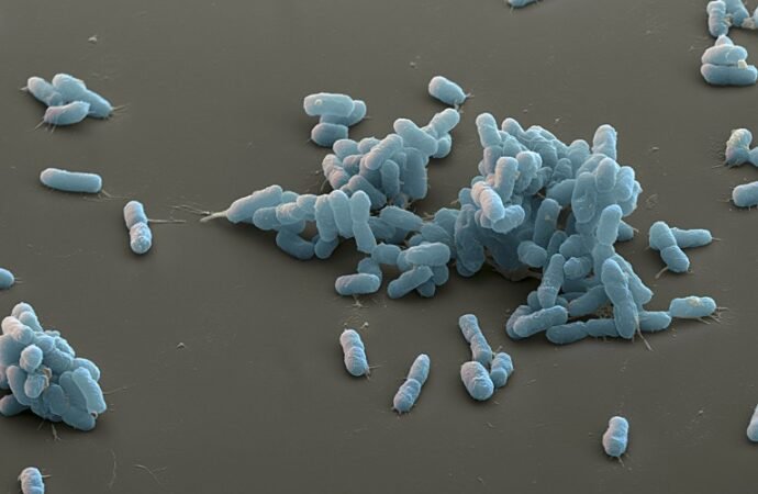 Plague scare: what scientists know — and what Russia won’t say