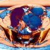 The ‘missed disease’ that affects 190 million: endometriosis drug shows early promise