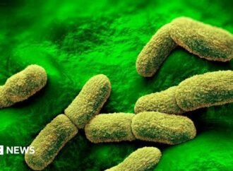 US ‘watching closely’ after plague researcher dies in Russia