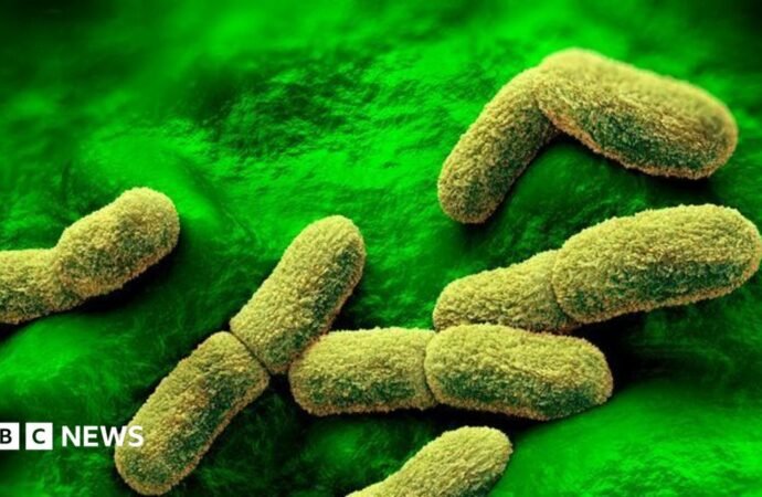 US ‘watching closely’ after plague researcher dies in Russia