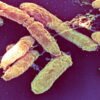 What is the pneumonic plague?
