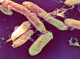 What is the pneumonic plague?