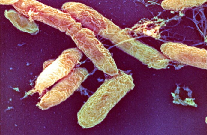 What is the pneumonic plague?
