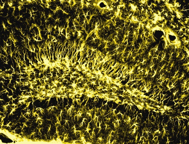 Confocal microscopy immunofluorescence micrograph of bright yellow branching networks of thread-like structures against a black background